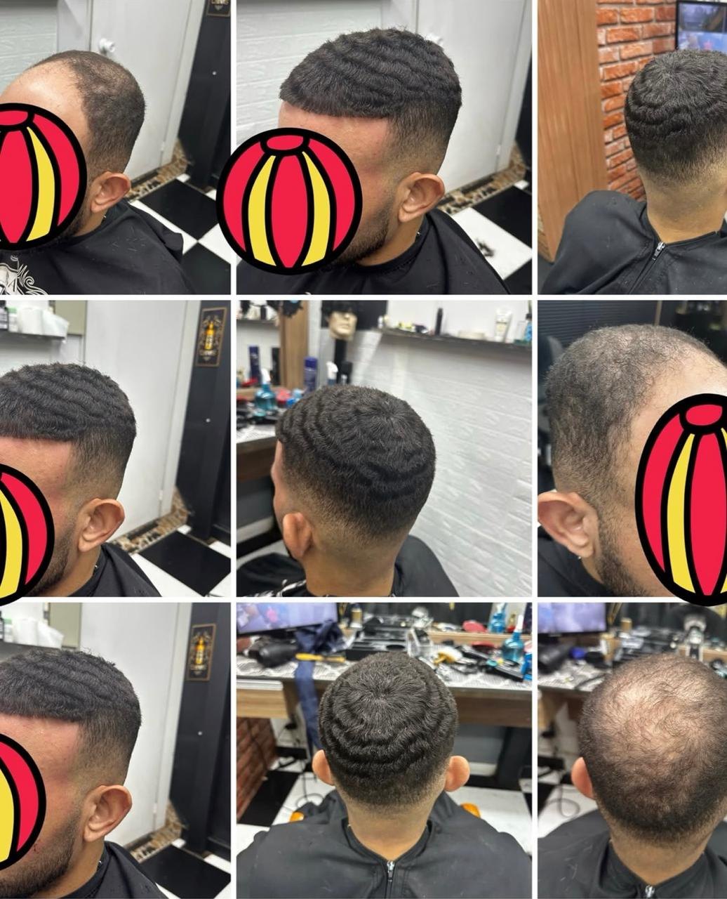 Sequência de antes e depois de prótese capilar masculina com corte curto